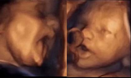 Cận cảnh thai nhi hát trong bụng mẹ