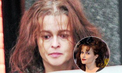 Sao Harry Potter bù xù xuống sắc trầm trọng trên phố