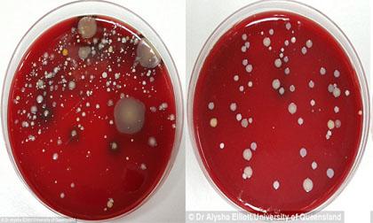 Cận cảnh vi khuẩn sống ở nơi công sở gây hại cho con người