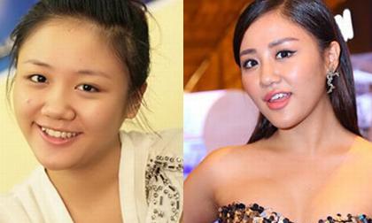 Tại sao môi và cằm Văn Mai Hương sưng méo khác lạ?