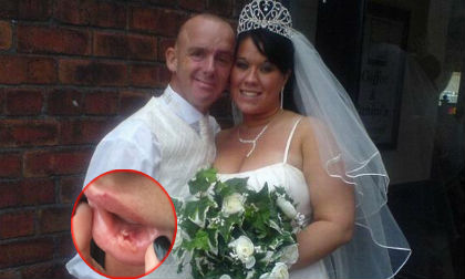 Hủy hoại bản thân, gia đình bất hòa vì phẫu thuật thẩm mỹ