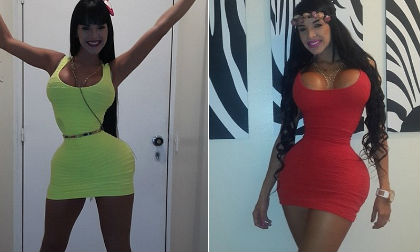 Người mẫu phẫu thuật thẩm mỹ 20 lần để có cơ thể hoàn hảo