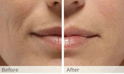 Những bí kíp làm đẹp tuyệt diệu mọi phụ nữ nên biết