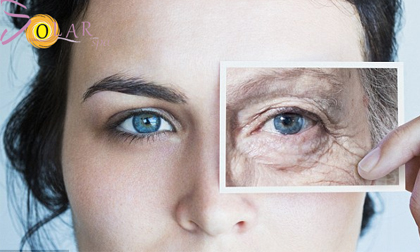 Xóa nhăn và đánh tan bọng mỡ mắt hiệu quả 70%-90% chỉ trong 90 phút