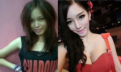Cô gái 'lột xác' thành hotgirl xinh đẹp sau khi phẫu thuật thẩm mỹ