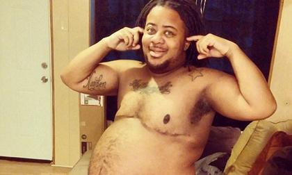 Người đàn ông sốc khi phát hiện mang thai 21 tuần 