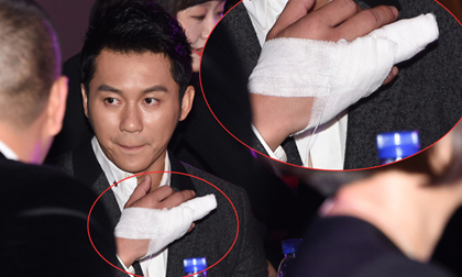 Lý Thần bất ngờ dự sự kiện với ngón tay bị băng bó