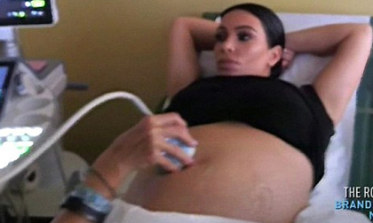 Kim Kardashian đau đớn xoay ngôi thai để được sinh thường