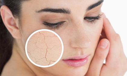 Lựa chọn trái cây làm đẹp trong mùa đông