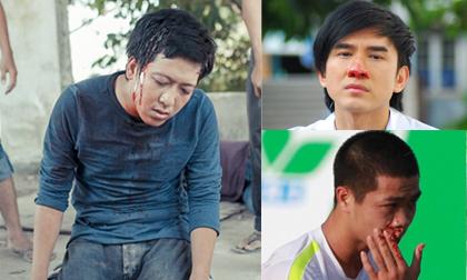 Nhan sắc của sao nam Việt khi bị sưng vù, bầm dập 