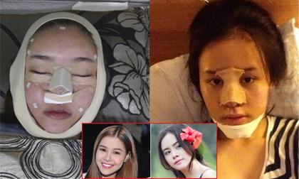 Loạt ảnh dao kéo của mỹ nhân Việt khiến fans rùng mình