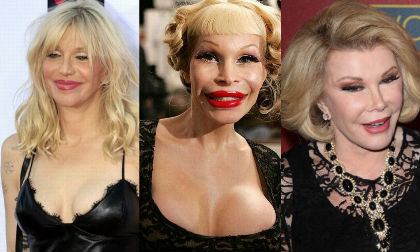 Loạt sao đình đám phải 'ôm hận' vì 'xấu như quỷ' sau khi phẫu thuật thẩm mỹ