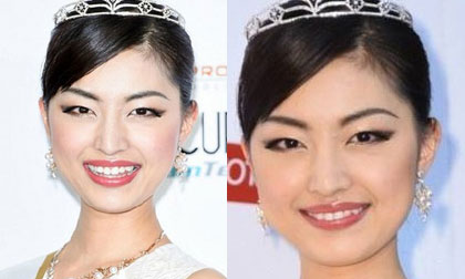 Tân Hoa hậu Hoàn vũ Nhật bị chê xấu