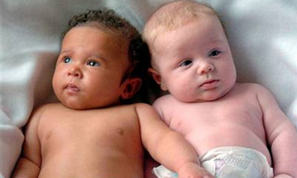 Những ca sinh đôi, sinh ba 'mỗi con một bố khác nhau'