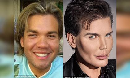 Chi gần 10 tỷ đồng với 42 lần phẫu thuật để trở thành người đàn ông lý tưởng