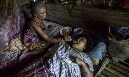 Cuộc sống địa ngục ở ngôi làng có hàng trăm người mắc bệnh tâm thần