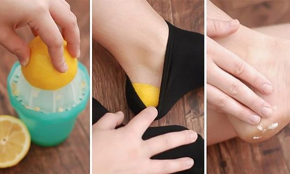 Bọc vỏ chanh vào gót chân... kết quả làm đẹp ngoài mong đợi
