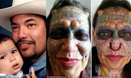 Người chuyển giới phẫu thuật thẩm mỹ để thành con rồng