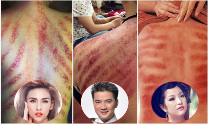 Hình ảnh cạo gió đáng sợ của sao Việt can đảm lắm mới dám nhìn