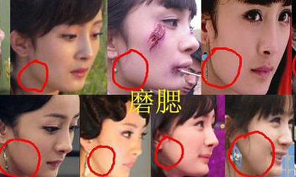 Mỹ nhân Dương Mịch bị biến dạng khuôn mặt