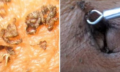 99% sẽ sốc khi biết sự thật chỗ bẩn nhất trên cơ thể