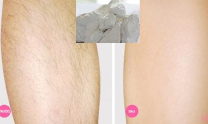 'Độc chiêu' triệt sạch lông tay chân vĩnh viễn chỉ bằng vôi sống