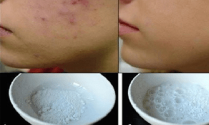 Hỗn hợp làm da mượt mà như nhung chỉ cần 5 phút!