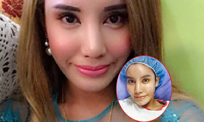 Nữ triệu phú Malaysia phẫu thuật cắt ngực để trở lại làm nam giới