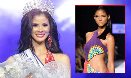 Nhan sắc tân Hoa hậu Hoàn vũ Dominican gây tranh cãi vì quá xấu