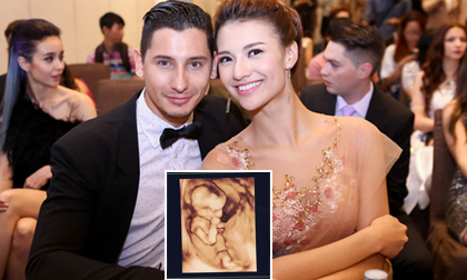 Hồng Quế bất ngờ đăng ảnh siêu âm, công khai chuyện mang bầu