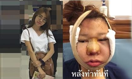 Hành trình đau đớn của cô gái Thái Lan 'lột xác' thành hotgirl
