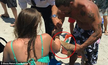 Cá mập ngoạm tay người không chịu nhả dù được đưa tới bệnh viện