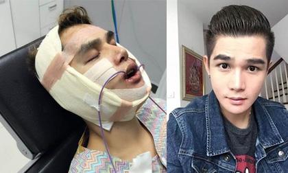 Chàng trai Thái vô tư công khai hành trình 'lột xác nhờ dao kéo'