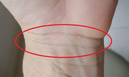 Xem ngấn cổ tay báo hiệu sức khỏe, vận mệnh tương lai