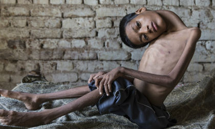 Câu chuyện cổ tích thần kỳ của cậu bé quay ngang đầu 180 độ