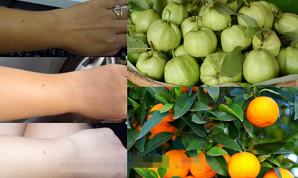 10 loại quả giúp trắng da nhất