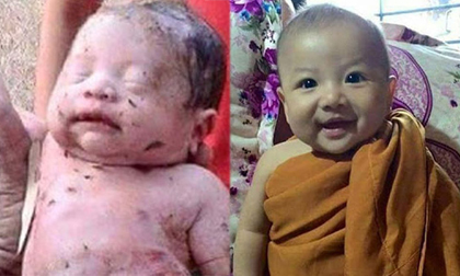 Bé bị chôn sống trên cánh đồng sống sót kỳ diệu ở Thái Lan