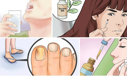 Lý do trong tủ thuốc luôn có một chai dầu cây trà