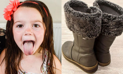 Bé gái 5 tuổi có hai nửa cơ thể phát triển nhanh chậm khác nhau