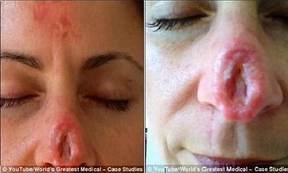 Tự ý bôi thuốc mỡ, cô gái phải chịu hậu quả không ngờ