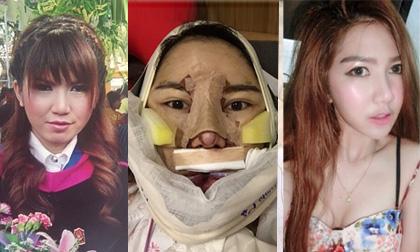 Hành trình 'lột xác' thành mỹ nữ đầy đau đớn của cô gái Thái Lan