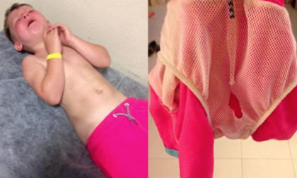 Nguy cơ 'hỏng cậu nhỏ' từ quần bơi lưới - bài học cho các bậc cha mẹ