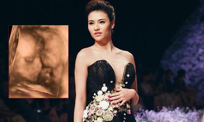 Hồng Quế lo lắng khi bác sĩ chẩn đoán thai nhi nhẹ cân