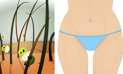 Cạo lông vùng kín: Cảnh báo tác dụng phụ khôn lường 