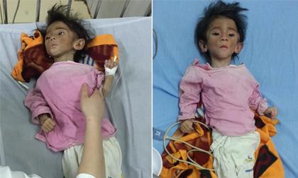 Xót xa em bé 14 tháng tuổi chỉ nặng 3,5 kg vì đói ở Lào Cai