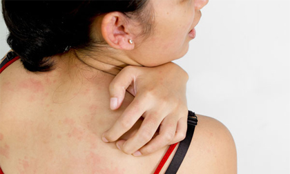 Những bệnh không ngờ tới từ việc ngồi nhiều điều hòa