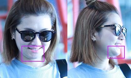 Selina để mặt mộc lộ sẹo ở cằm khi ra sân bay