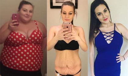 Màn giảm cân ngoạn mục từ 146 kg xuống còn 57 kg