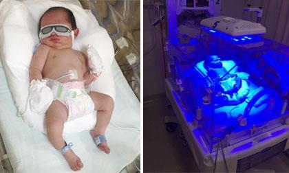 Con trai mới sinh của Lý Hải có chỉ số vàng da hơi cao