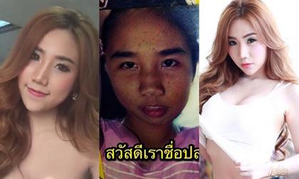 Hotgirl thay đổi diện mạo ngoạn mục nhờ thẩm mỹ